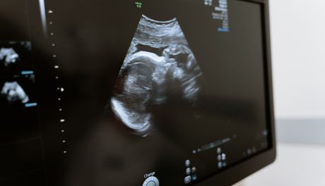 Rusza Program Badań Prenatalnych