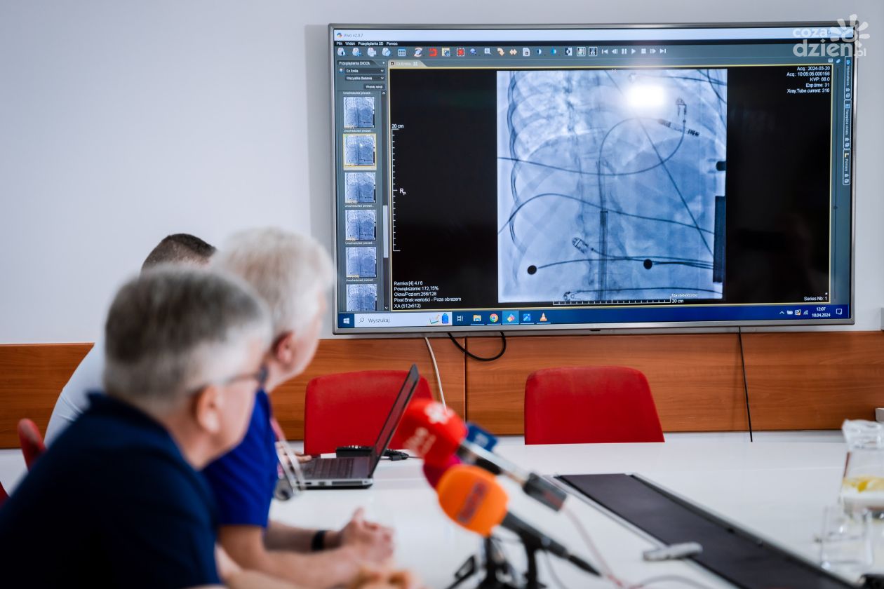 Stymulator serca wielkości małej baterii w Mazowieckim Szpitalu Specjalistycznym 